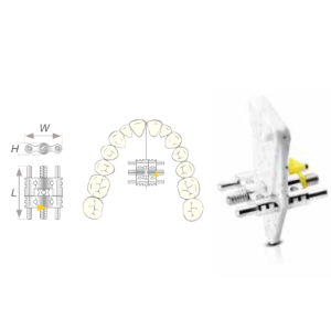 Vector 200, Scheu Dental