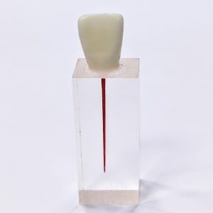 Эндоблок тренировочный (резец, один канал окрашен)-N5/1