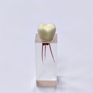 Эндоблок тренировочный (моляр, три канала окрашены) -N5/3