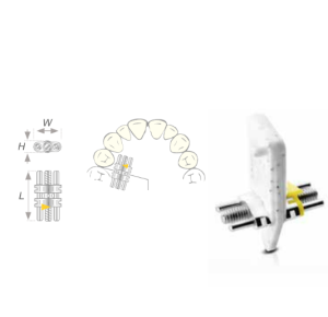 Vector 140, Scheu Dental